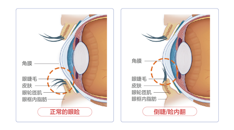 90d85477ebd1e1c07db1df87be9eb709.png 90d85477ebd1e1c07db1df87be9eb709.png